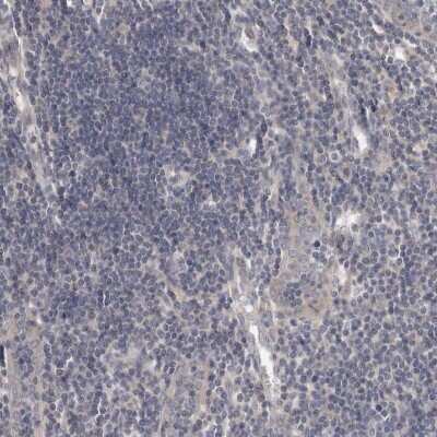 Immunohistochemistry-Paraffin: LRP-6 Antibody [NBP1-86345] - Staining of human lymph node shows low expression as expected.