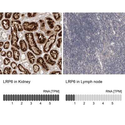 Immunohistochemistry-Paraffin: LRP-6 Antibody [NBP1-86345] - Staining in human kidney and lymph node tissues using anti-LRP6 antibody. Corresponding LRP6 RNA-seq data are presented for the same tissues.