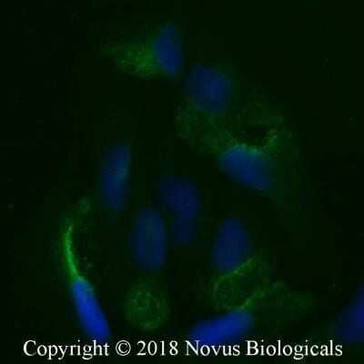 Immunocytochemistry/Immunofluorescence: LRP2 Antibody (CD7D5) - Azide and BSA Free [NBP2-80836] - U2OS cells were fixed for 10 minutes using 10% formalin and then permeabilized for 5 minutes using 1X PBS + 0.1% Saponin. The cells were incubated with anti-LRP2 (CD7D5) at 20 ug/ml overnight at 4C and detected with an anti-mouse Dylight 488 (Green) at a 1:500 dilution. Nuclei were counterstained with DAPI (Blue). Cells were imaged using a 40X objective. Image from the standard format of this antibody.