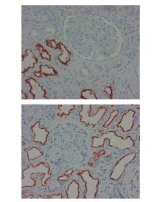 Immunohistochemistry-Paraffin: LRP2 Antibody (CD7D5) - Azide and BSA Free [NBP2-80836] - Staining (paraffin-embedded tissue-sections fixed in formalin) of Megalin in the brush border of the proximal tubule. Image from the standard format of this antibody.