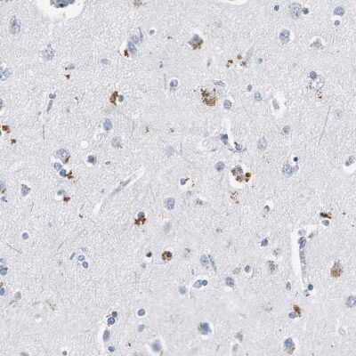 <b>Orthogonal Strategies Validation. </b>Immunohistochemistry-Paraffin: LRP2 Antibody [NBP1-85292] - Staining of human cerebral cortex shows moderate cytoplasmic positivity in neuronal cells.