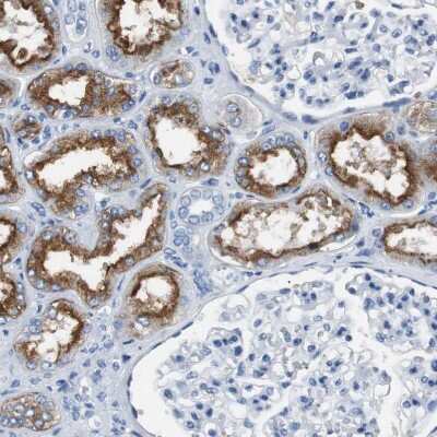 Immunohistochemistry-Paraffin: LRP2 Antibody [NBP1-85292] - Staining of human kidney shows strong cytoplasmic positivity in cells in tubules.