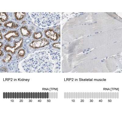 Immunohistochemistry-Paraffin: LRP2 Antibody [NBP1-85292] - Staining in human kidney and skeletal muscle tissues.. Corresponding LRP2 RNA-seq data are presented for the same tissues.