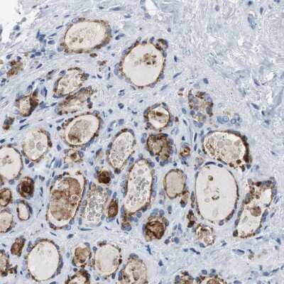 Immunohistochemistry-Paraffin: LRP2 Antibody [NBP1-85292] - Staining of human thyroid gland shows moderate to strong cytoplasmic positivity in glandular cells.