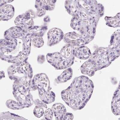 <b>Orthogonal Strategies Validation. </b>Immunohistochemistry-Paraffin: LRP2 Antibody [NBP2-39033] - Staining of human placenta shows no positivity in trophoblastic cells as expected.