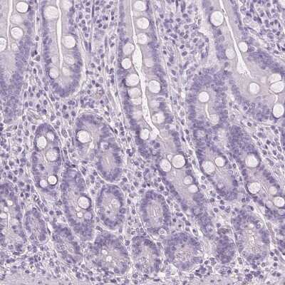 Immunohistochemistry-Paraffin: LRP2 Antibody [NBP2-39033] - Staining of human small intestine shows no positivity in glandular cells as expected.