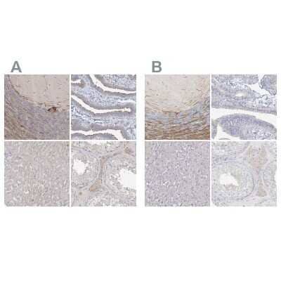 Immunohistochemistry-Paraffin: LRP2BP Antibody [NBP1-84096] - Staining of human cerebellum, fallopian tube, liver and testis using Anti-LRP2BP antibody NBP1-84096 (A) shows similar protein distribution across tissues to independent antibody NBP1-84097 (B).