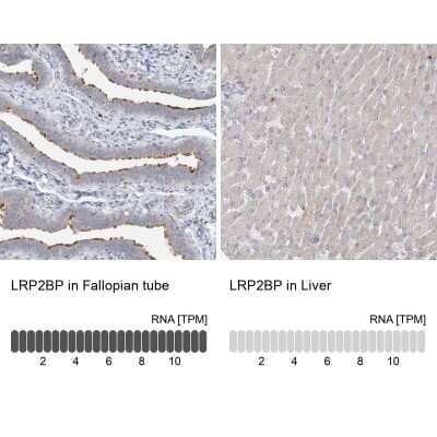 Immunohistochemistry-Paraffin: LRP2BP Antibody [NBP1-84096] - Analysis in human fallopian tube and liver tissues. Corresponding LRP2BP RNA-seq data are presented for the same tissues.