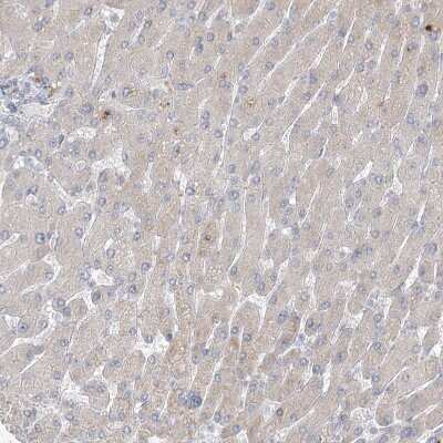 Immunohistochemistry-Paraffin: LRP2BP Antibody [NBP1-84096] - Staining of human liver shows only very low positivity in hepatocytes as expected.