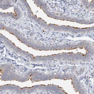 Immunohistochemistry-Paraffin: LRP2BP Antibody [NBP1-84096] - Staining of human fallopian tube shows moderate positivity in cilia in glandular cells.