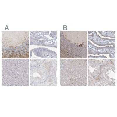 <b>Independent Antibodies Validation and Orthogonal Strategies Validation.</b>Immunohistochemistry-Paraffin: LRP2BP Antibody [NBP1-84097] - Staining of human cerebellum, fallopian tube, liver and testis using Anti-LRP2BP antibody NBP1-84097 (A) shows similar protein distribution across tissues to independent antibody NBP1-84096 (B).