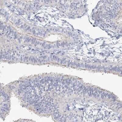 Immunohistochemistry-Paraffin: LRP2BP Antibody [NBP1-84097] - Staining of human fallopian tube shows moderate positivity in cilia in glandular cells.