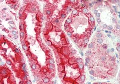 Immunohistochemistry-Paraffin: LRP2BP Antibody [NBP2-87741] - Rabbit Anti-Lrp2bp antibody. Formalin Fixed Paraffin Embedded Tissue: Human Kidney. Primary antibody Concentration: 1:100. Secondary Antibody: Donkey anti-Rabbit-Cy3. Secondary Antibody Concentration: 1:200. Magnification: 20x.