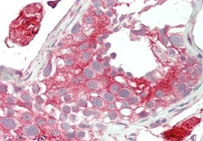 Immunohistochemistry-Paraffin: LRP2BP Antibody [NBP2-87741] - Rabbit Anti-Lrp2bp antibody. Formalin Fixed Paraffin Embedded Tissue: Human Testis. Primary antibody Concentration: 1:100. Secondary Antibody: Donkey anti-Rabbit-Cy3. Secondary Antibody Concentration: 1:200. Magnification: 20x.