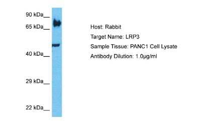 Western Blot: LRP3 Antibody [NBP2-84145] - Host: Rabbit. Target Name: LRP3. Sample Type: PANC1 Whole Cell lysates. Antibody Dilution: 1.0ug/ml