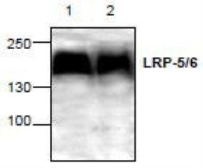 Western Blot: LRP5/6 Antibody [NBP1-45687] - Analysis of LRP-5/6 with Jurkat cell lysate. Lane 1: 100 ug; Lane 2: 50 ug.