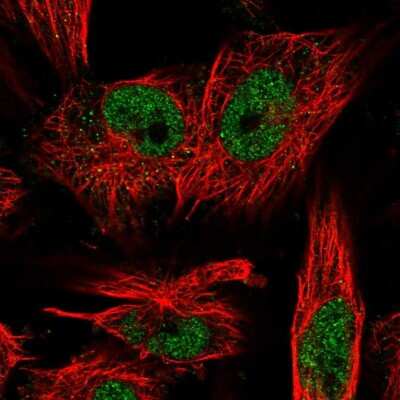 Immunocytochemistry/Immunofluorescence: LRP5L Antibody [NBP1-90543] - Immunofluorescent staining of human cell line U-251 MG shows localization to nucleoplasm.