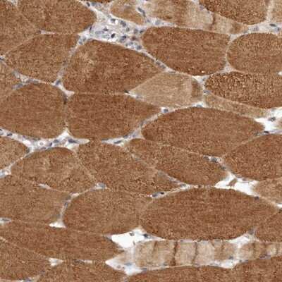 Immunohistochemistry-Paraffin: LRP5L Antibody [NBP1-90543] - Staining of human skeletal muscle shows moderate cytoplasmic positivity in myocytes.