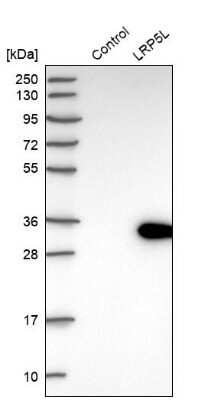 Western Blot: LRP5L Antibody [NBP1-90543] - Analysis in control (vector only transfected HEK293T lysate) and LRP5L over-expression lysate (Co-expressed with a C-terminal myc-DDK tag (3.1 kDa) in mammalian HEK293T cells).