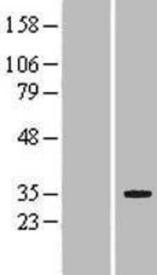 Western Blot: LRP5L Overexpression Lysate (Adult Normal) [NBP2-04856] Left-Empty vector transfected control cell lysate (HEK293 cell lysate); Right -Over-expression Lysate for LRP5L.