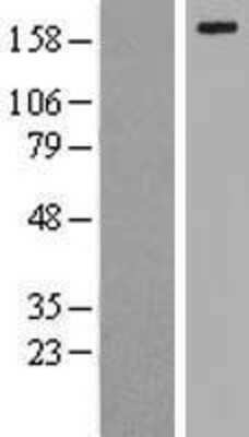 Western Blot: LRP6 Overexpression Lysate (Adult Normal) [NBL1-12672] Left-Empty vector transfected control cell lysate (HEK293 cell lysate); Right -Over-expression Lysate for LRP6.