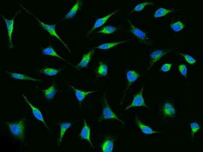 Immunocytochemistry/Immunofluorescence: LRPAP Antibody [NBP2-99549] - Immunofluorescence staining of LRPAP in HeLa cells. Cells were fixed with 4% PFA, permeabilzed with 0.1% Triton X-100 in PBS, blocked with 10% serum, and incubated with rabbit anti-Human LRPAP polyclonal antibody (dilution ratio 1:1000) at 4C overnight. Then cells were stained with the Alexa Fluor(R)488-conjugated Goat Anti-rabbit IgG secondary antibody (green) and counterstained with DAPI (blue).Positive staining was localized to Cytoplasm.