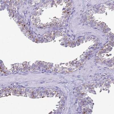 Immunohistochemistry-Paraffin: LRRC10B Antibody [NBP2-33493] - Staining of human prostate shows strong positivity with a granular pattern.