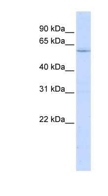 Western Blot: LRRC15 Antibody [NBP1-91365] - Hela cell lysate, concentration 0.2-1 ug/ml.
