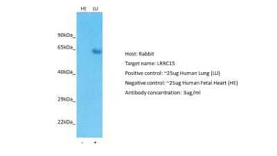 Western Blot: LRRC15 Antibody [NBP1-91365] - Host: Rabbit. Target: LRRC15. Positive control (+): Human Lung (LU). Negative control (-): Human Fetal Heart (HE). Antibody concentration: 3ug/ml