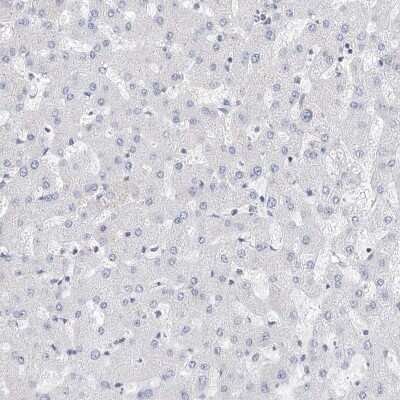 Immunohistochemistry-Paraffin LRRC16A Antibody