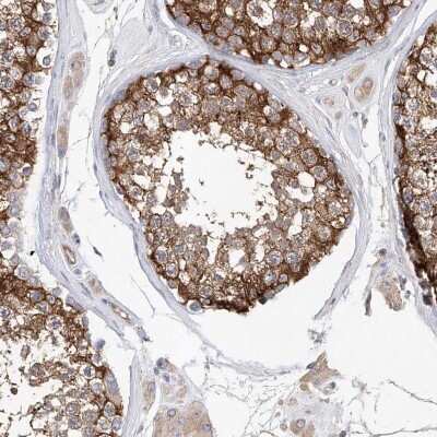 Immunohistochemistry-Paraffin LRRC16A Antibody