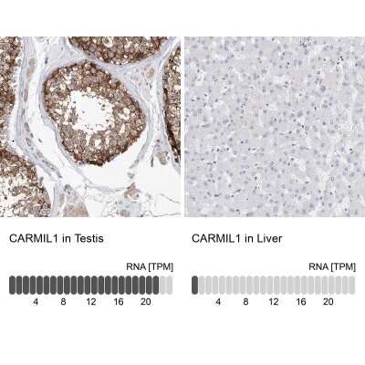 Immunohistochemistry-Paraffin: LRRC16A Antibody [NBP1-91222] - Staining in human testis and liver tissues using anti-CARMIL1 antibody. Corresponding CARMIL1 RNA-seq data are presented for the same tissues.