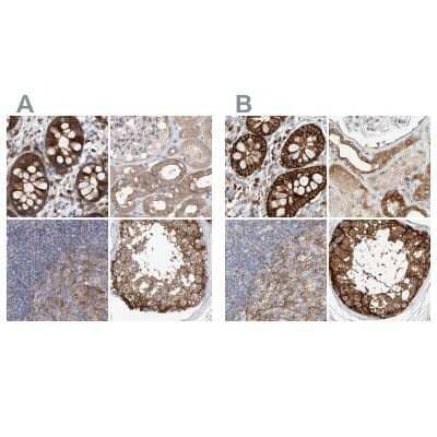 Immunohistochemistry-Paraffin: LRRC16A Antibody [NBP1-91222] - Staining of human colon, kidney, lymph node and testis using Anti-CARMIL1 antibody NBP1-91222 (A) shows similar protein distribution across tissues to independent antibody NBP1-91221 (B).