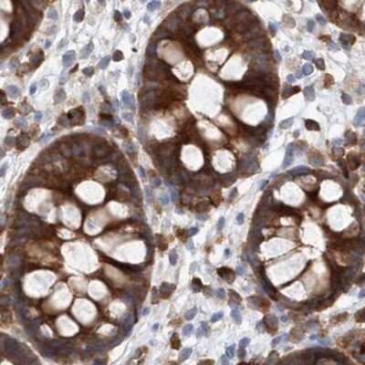 Immunohistochemistry-Paraffin: LRRC16A Antibody [NBP1-91222] - Staining of human colon.