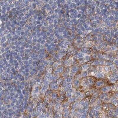 Immunohistochemistry-Paraffin: LRRC16A Antibody [NBP1-91222] - Staining of human lymph node.