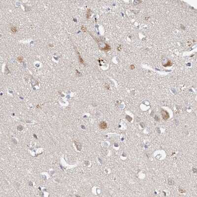 Immunohistochemistry-Paraffin: LRRC16B Antibody [NBP1-88687] - Staining of human cerebral cortex shows weak cytoplasmic positivity in neurons.