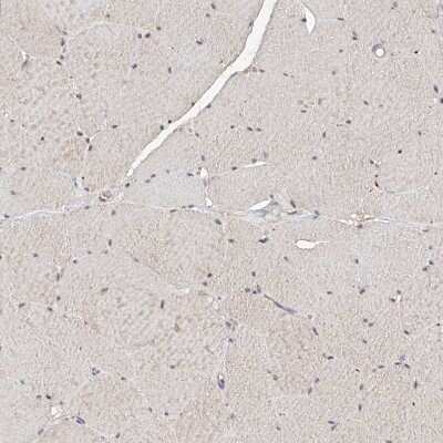 Immunohistochemistry-Paraffin: LRRC16B Antibody [NBP1-88687] - Staining of human skeletal muscle shows low positivity in myocytes as expected.