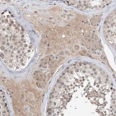 Immunohistochemistry-Paraffin: LRRC16B Antibody [NBP1-88687] - Staining of human testis shows moderate cytoplasmic positivity in Leydig cells.