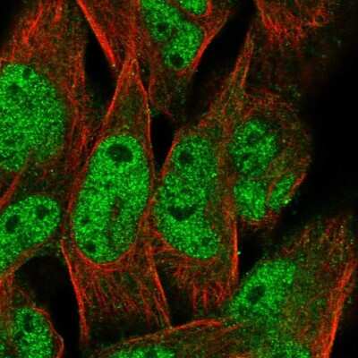 Immunocytochemistry/Immunofluorescence: LRRC17 Antibody [NBP1-83309] - Staining of human cell line RH-30 shows localization to nucleoplasm & cytosol. Antibody staining is shown in green.