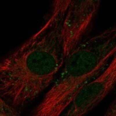 Immunocytochemistry/ Immunofluorescence LRRC17 Antibody - BSA Free