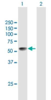 Western Blot: LRRC17 Antibody [H00010234-B01P] - Analysis of LRRC17 expression in transfected 293T cell line by LRRC17 polyclonal antibody.  Lane 1: LRRC17 transfected lysate(48.51 KDa). Lane 2: Non-transfected lysate.