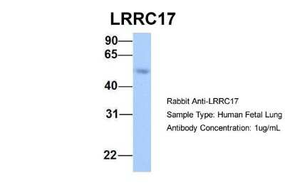 Western Blot: LRRC17 Antibody [NBP1-55529] - Human Fetal Lung, Antibody Dilution: 1.0 ug/ml.