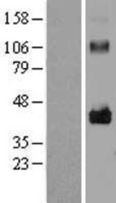 Western Blot LRRC17 Overexpression Lysate