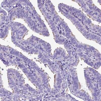Immunohistochemistry-Paraffin: LRRC18 Antibody [NBP1-81102] - Staining of human fallopian tube shows high expression.
