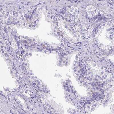 Immunohistochemistry-Paraffin: LRRC18 Antibody [NBP1-81102] - Staining of human prostate shows low expression as expected.