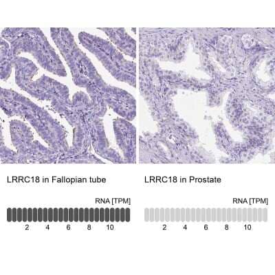 <b>Orthogonal Strategies Validation. </b>Immunohistochemistry-Paraffin: LRRC18 Antibody [NBP1-81102] - Staining in human fallopian tube and prostate tissues using anti-LRRC18 antibody. Corresponding LRRC18 RNA-seq data are presented for the same tissues.