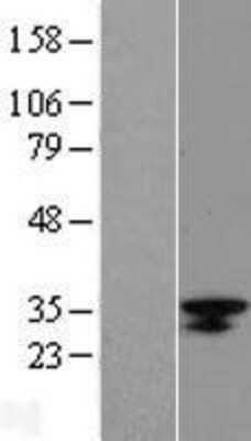 Western Blot: LRRC18 Overexpression Lysate (Adult Normal) [NBL1-12678] Left-Empty vector transfected control cell lysate (HEK293 cell lysate); Right -Over-expression Lysate for LRRC18.