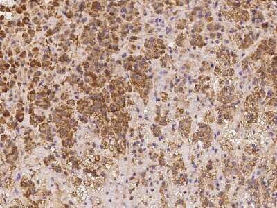 Immunohistochemistry-Paraffin: LRRC19 Antibody [NBP2-97212] - Immunochemical staining of human LRRC19 in human adrenal gland with rabbit polyclonal antibody at 1:500 dilution, formalin-fixed paraffin embedded sections.