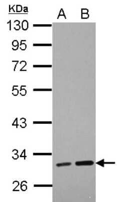 Western Blot: LRRC19 Antibody [NBP2-17167] - Sample (30 ug of whole cell lysate) A: PC-3 B: U87-MG 10% SDS PAGE gel, diluted at 1:3000.