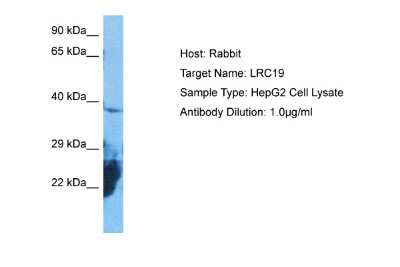 Western Blot: LRRC19 Antibody [NBP2-84147] - Host: Rabbit. Target Name: LRRC19. Sample Tissue: Human HepG2 Whole Cell. Antibody Dilution: 1.0ug/ml